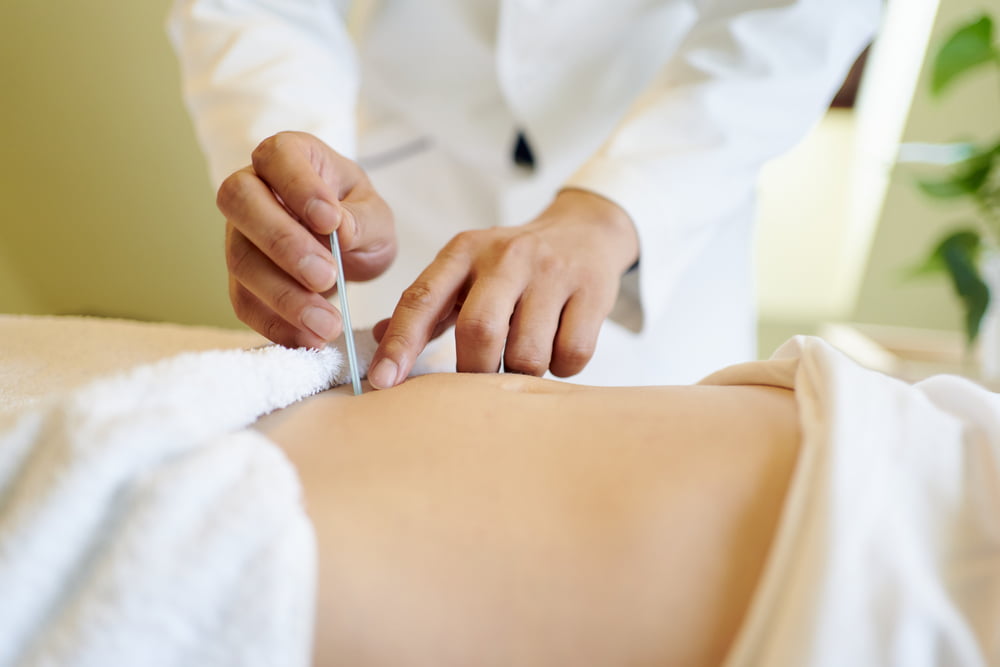 Dry Needling in Flower Mound, TX Dry Needling in Flower Mound, TX