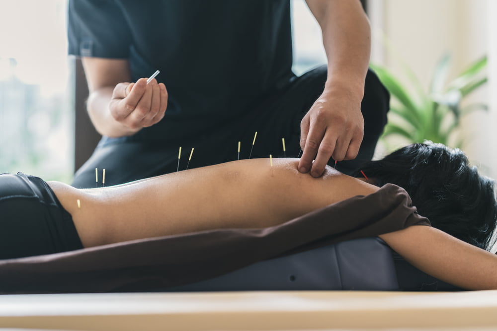 Dry Needling in Flower Mound, TX Dry Needling in Flower Mound, TX